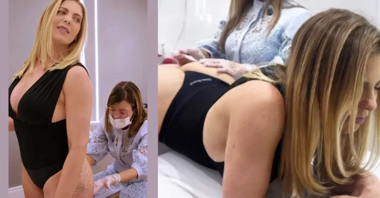 Sheila Mello enfrenta tratamento após sequelas de hidrogel