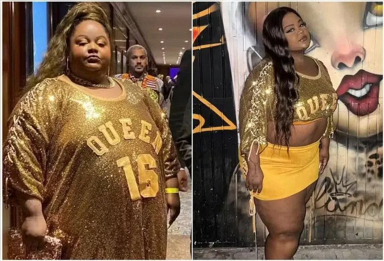 Antes e depois de MC Carol