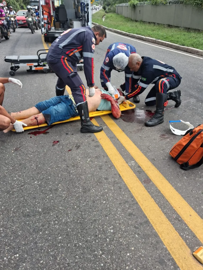 Atendimento do SAMU ao motociclista ferido após colisão na Rodovia Arthur Bernardes.