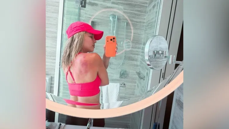 Na manhã desta quarta-feira (14), Zarazúa voltou a se manifestar para tranquilizar os seguidores