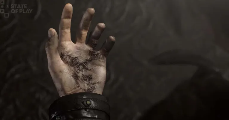 Leon está infectado e correndo contra o tempo?