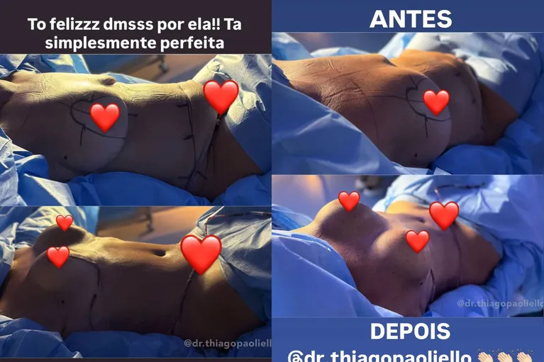 Virginia mostra cirurgia plástica da mãe e comemora: "Corpinho de Jovem!"