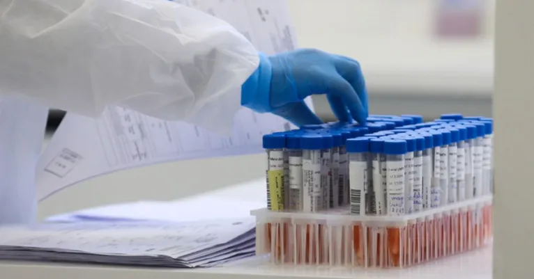 Amostras foram roubadas e colocaram em risco saúde nacional (imagem ilustrativas)