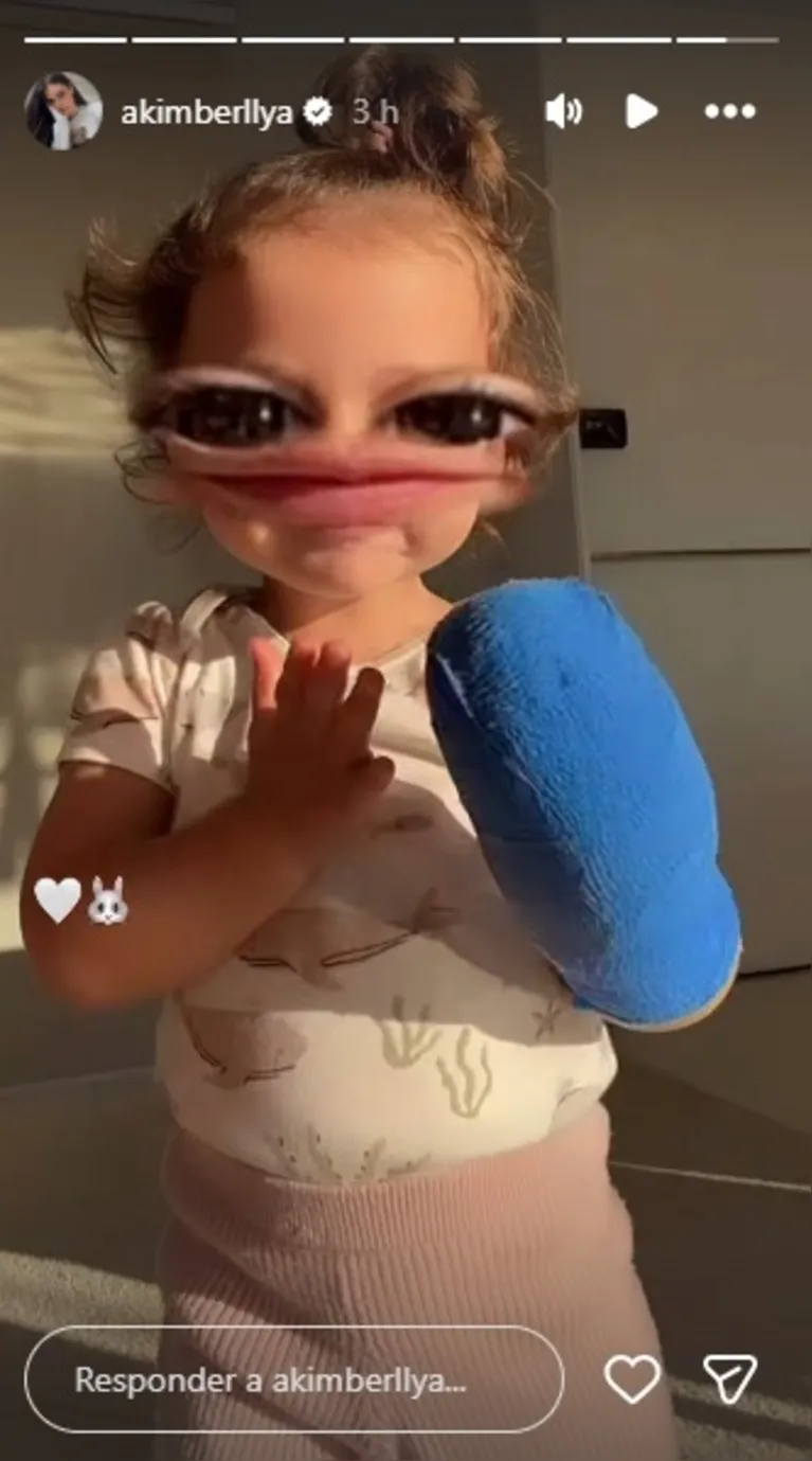 Amanda Kimberlly mostra dedo da filha com Neymar após acidente grave