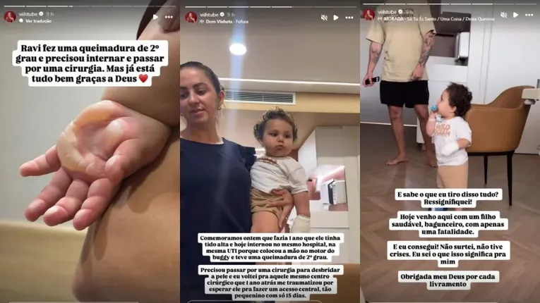 Eliezer atualiza estado de saúde do filho após queimadura grave