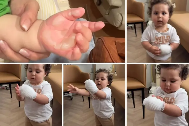 Eliezer atualiza estado de saúde do filho após queimadura grave