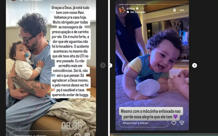 Eliezer atualiza estado de saúde do filho após queimadura grave