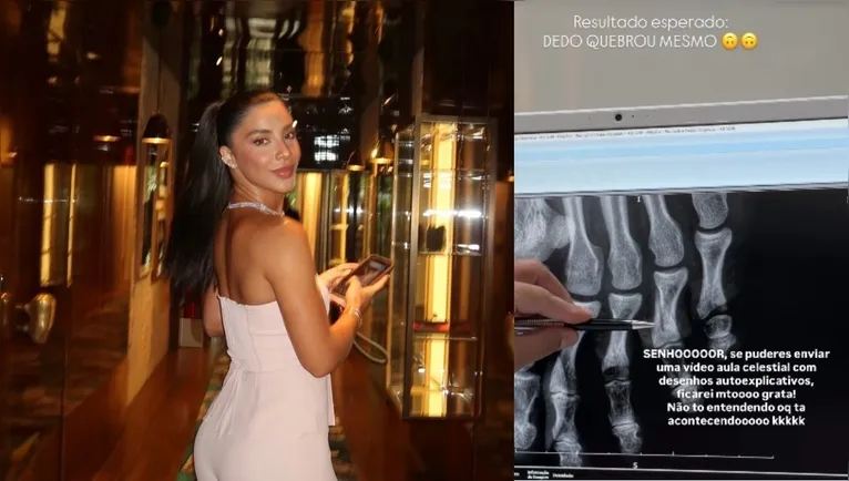 Gabriela Versiani mostra fratura no pé após acidente em casa