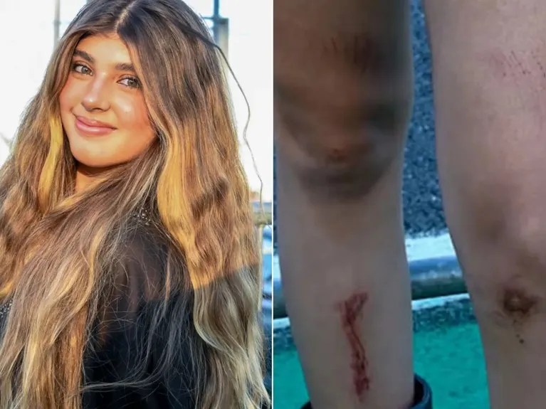 Sofia Massafera após a queda no Lollapalooza Brasil, exibindo escoriações nas pernas enquanto seguia aproveitando o evento.