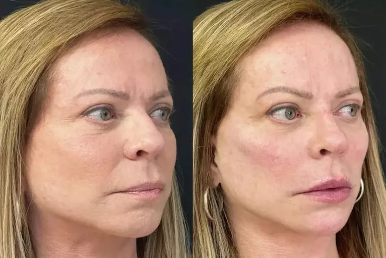 Christina Rocha exibe corpo escultural aos 68 anos. Veja!