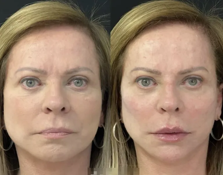 Christina Rocha exibe corpo escultural aos 68 anos. Veja!