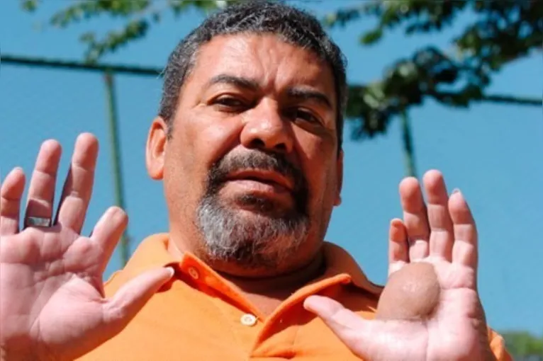 Odesson Ferreira, irmão de Devair.