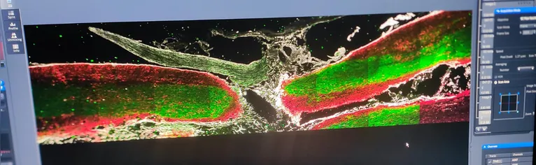 Pesquisa avança para a fase 1 de testes aprovados pela Anvisa