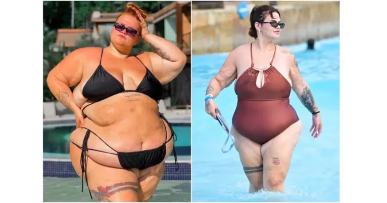 Thais Carla impressiona com antes e depois após perder 100 kg