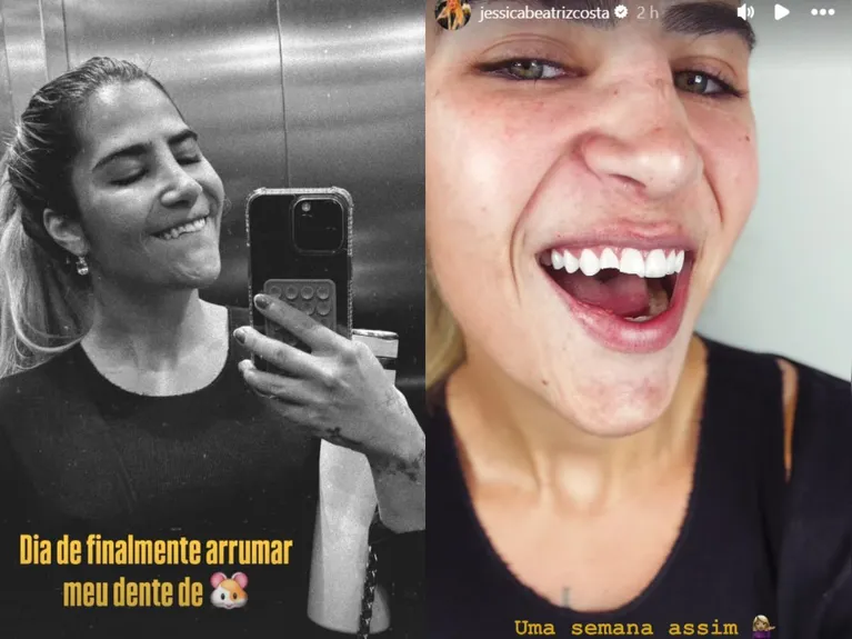 Filha de Leonardo sofre queda e quebra dentes; veja foto