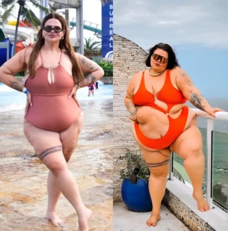 Antes e depois de Thais Carla após perder 100kg.