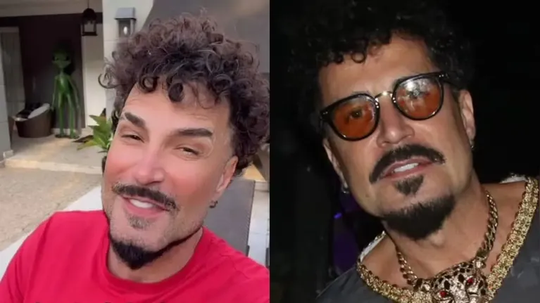 Vini Jr. não é o único: famosos que aderiram à harmonização facial