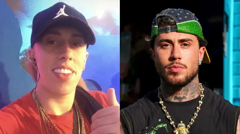 Vini Jr. não é o único: famosos que aderiram à harmonização facial