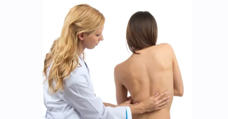 Escoliose em adolescentes: como identificar e quando procurar um especialista
