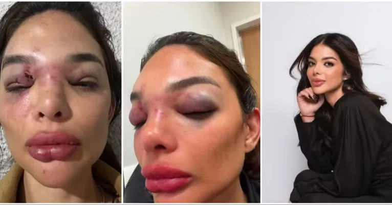 Empresário da Faria Lima é preso após acusação de agredir esposa em SP
