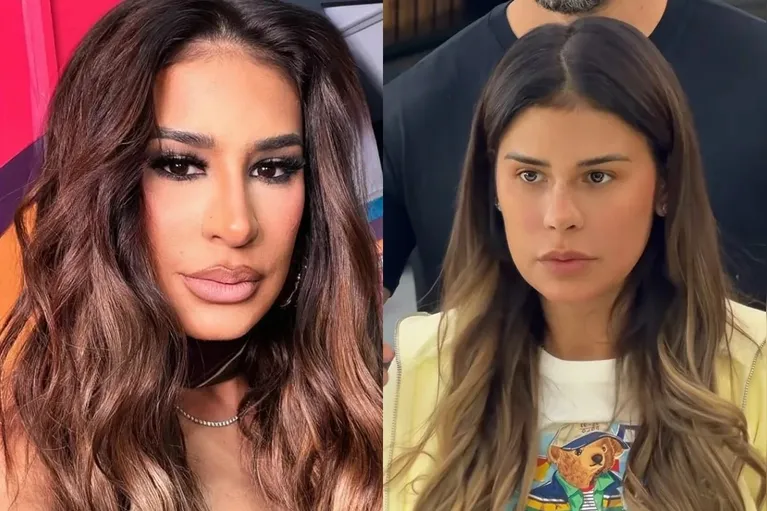 Simone Mendes abre o jogo sobre mudança no nariz; veja antes e depois