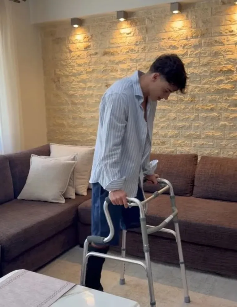 Stavros após perder a perna esquerda em acidente no reality 'Survivor'