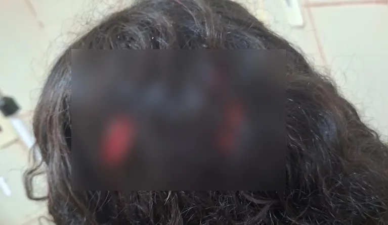 A adolescente sofreu vários golpes de faca na cabeça