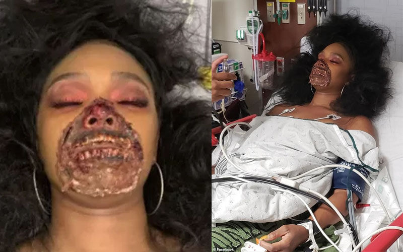 Mulher com maquiagem de zumbi confunde médicos e é atendida em hospital -  Revista Marie Claire