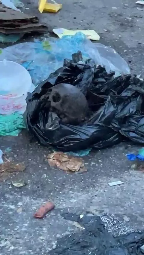 Imagem ilustrativa da notícia Vídeo: ossada humana é encontrada no bairro do Telégrafo