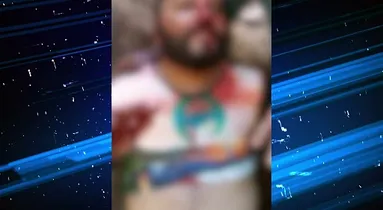 Imagem ilustrativa da imagem VÍDEO: Homem fica gravemente ferido após ser atacado por pitbull no Pará