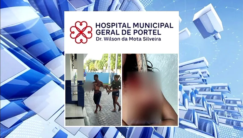 Imagem ilustrativa da notícia: Criança é empalada pela axila enquanto brincava no Marajó