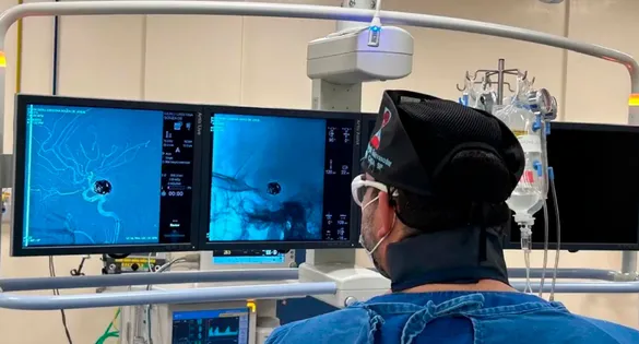 Desde junho de 2022, a unidade oferece a embolização cerebral, um procedimento minimamente invasivo que trata o aneurisma sem a necessidade de cirurgia aberta.